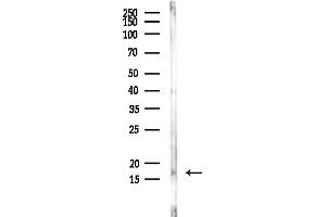 anti-Myosin Light Chain 6, Alkali, Smooth Muscle and Non Muscle (MYL6) (Internal Region) antibody
