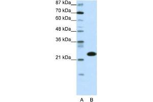 Transfected 293T; WB Suggested Anti-TAF11 Antibody Titration: 0. (TAF11 antibody  (N-Term))