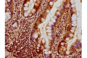 IHC image of ABIN7150845 diluted at 1:300 and staining in paraffin-embedded human small intestine tissue performed on a Leica BondTM system. (OPA1 antibody  (AA 183-418))