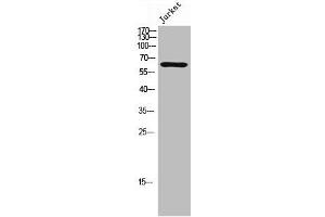 Western Blot analysis of Jurkat cells using Phospho-TIP60 (S86) Polyclonal Antibody (KAT5 antibody  (pSer86))