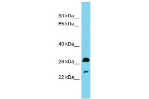 Host: Rabbit Target Name: HSD17B13 Sample Type: Fetal Brain lysates Antibody Dilution: 1. (HSD17B13 antibody  (N-Term))