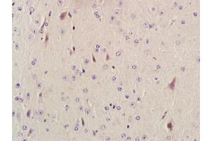 Paraformaldehyde-fixed, paraffin embedded mouse brain; Antigen retrieval by boiling in sodium citrate buffer (pH6. (AKAP12 antibody  (AA 701-900))