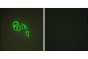 Immunofluorescence analysis of A549 cells, using DOK6 Antibody. (DOK6 antibody  (AA 111-160))