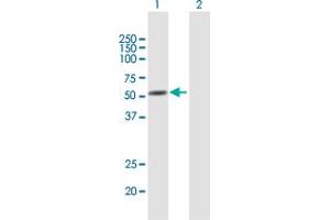 Western Blot analysis of ANXA11 expression in transfected 293T cell line by ANXA11 MaxPab polyclonal antibody. (Annexin A11 antibody  (AA 1-505))