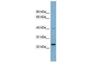 HSPC111 antibody used at 1 ug/ml to detect target protein. (NOP16 antibody  (Middle Region))