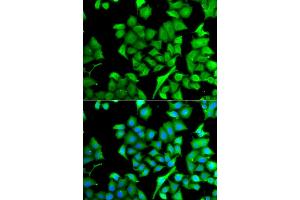 Immunofluorescence analysis of A549 cells using NAA50 antibody (ABIN5975518). (NAA50 antibody)