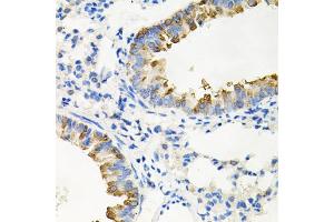 Immunohistochemistry of paraffin-embedded mouse lung using IRAK2 antibody (ABIN5971467) at dilution of 1/100 (40x lens). (IRAK2 antibody)