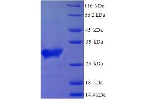 SDS-PAGE (SDS) image for Saitohin (STH) (AA 1-128), (full length) protein (His-SUMO Tag) (ABIN5710424) (STH Protein (AA 1-128, full length) (His-SUMO Tag))
