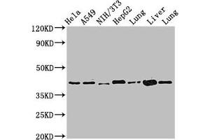 Western Blot Positive WB detected in: Hela whole cell lysate, A549 whole cell lysate, NIH/3T3 whole cell lysate, HepG2 whole cell lysate, Rat lung tissue, Mouse liver tissue, Mouse lung tissue All lanes: ACAA2 antibody at 2. (ACAA2 antibody  (AA 188-257))