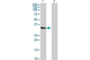 Western Blot analysis of UNC119 expression in transfected 293T cell line by UNC119 monoclonal antibody (M01), clone 2F9-2A9. (UNC119 antibody  (AA 1-240))