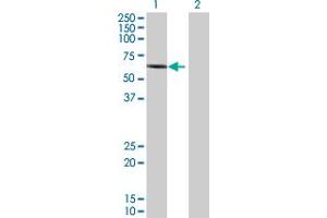 Western Blot analysis of RIPK2 expression in transfected 293T cell line by RIPK2 MaxPab polyclonal antibody. (RIPK2 antibody  (AA 1-540))