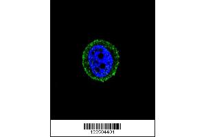 Confocal immunofluorescent analysis of CALCR Antibody with MCF-7 cell followed by Alexa Fluor 488-conjugated goat anti-rabbit lgG (green). (MICU1 antibody  (C-Term))