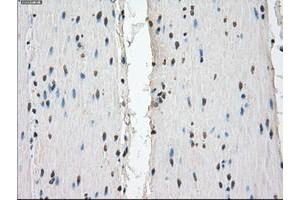 Image no. 8 for anti-Fc gamma RII (CD32) antibody (ABIN1497254) (Fc gamma RII (CD32) antibody)