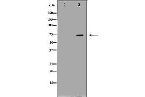 Western blot analysis of extracts of Hela , using TBRG4 antibody. (TBRG4 antibody  (C-Term))