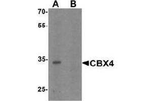 Western blot analysis of CBX4 in human brain tissue lysate with CBX4 Antibody  at 1 μg/ml in (A) the absence and (B) the presence of blocking peptide.