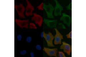 GUCA1A Mouse Monoclonal Antibody staining Hela cells by IF/ICC.