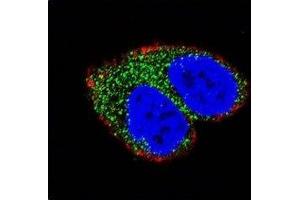 Confocal immunofluorescent analysis of AIM2 antibody with MCF-7 cells followed by Alexa Fluor 488-conjugated goat anti-rabbit lgG (green). (AIM2 antibody  (AA 1-50))