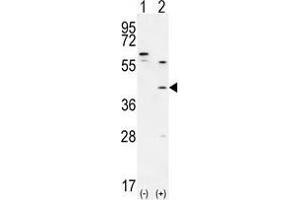 Western blot analysis of TGIF1 (arrow) using rabbit polyclonal TGIF1 Antibody (Center A160) . (TGIF1 antibody  (Middle Region))