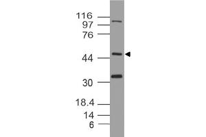 Image no. 1 for anti-Thioredoxin Interacting Protein (TXNIP) (AA 50-300) antibody (ABIN5027615) (TXNIP antibody  (AA 50-300))