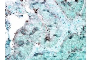 Immunohistochemistry analysis using Mouse Anti-Hsp90 Monoclonal Antibody, Clone 4F3. (HSP90 antibody  (PerCP))