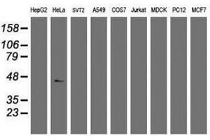 Image no. 3 for anti-Chromobox Homolog 8 (CBX8) (AA 1-260) antibody (ABIN1490661) (CBX8 antibody  (AA 1-260))