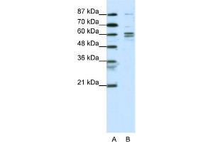 WB Suggested Anti-GTF2F1 Antibody Titration:  0. (GTF2F1 antibody  (N-Term))