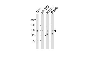 Western blot analysis of lysates from A431, mouse NIH/3T3 cell line, mouse brain, rat brain tissue lysate(from left to right), using Ephb1 Antibody (Center) (ABIN6243653 and ABIN6577762).