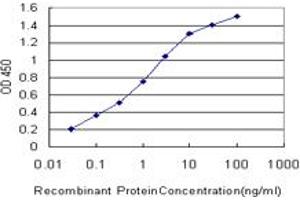Detection limit for recombinant GST tagged TROVE2 is approximately 0. (TROVE2 antibody  (AA 1-100))
