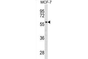 Western Blotting (WB) image for anti-Gc antibody (ABIN2930430) (Gc antibody)