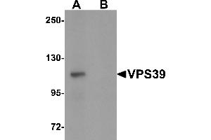 Western Blotting (WB) image for anti-Vacuolar Protein Sorting 39 Homolog (VPS39) (C-Term) antibody (ABIN1030796) (VPS39 antibody  (C-Term))