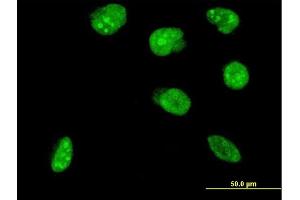 Immunofluorescence of monoclonal antibody to NHLH2 on HeLa cell. (NHLH2 antibody  (AA 36-135))