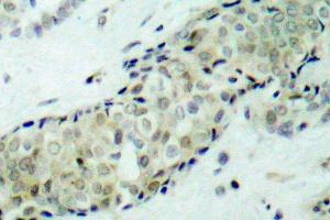 Image no. 1 for anti-Histone Deacetylase 5 (HDAC5) antibody (ABIN265457) (HDAC5 antibody)