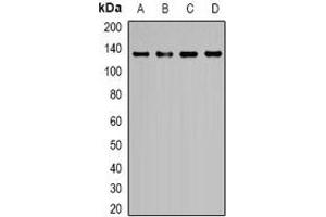 Western blot analysis of EGF expression in K562 (A), Hela (B), HEK293T (C), NIH3T3 (D) whole cell lysates. (EGF antibody)