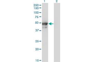 Western Blot analysis of KRT8 expression in transfected 293T cell line by KRT8 monoclonal antibody (M02), clone 3E3. (KRT8 antibody  (AA 91-195))