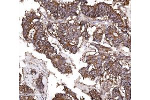 IHC analysis of Claudin 3/CLDN3 using anti-Claudin 3/CLDN3 antibody (ABIN7599626).