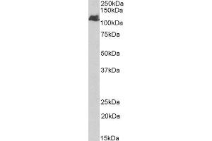 ABIN4902556 (1µg/ml) staining of Human Liver lysate (35µg protein in RIPA buffer). (BMPR2 antibody)