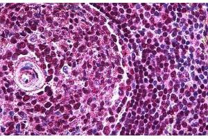 Human Spleen: Formalin-Fixed, Paraffin-Embedded (FFPE) (PAX5 antibody  (AA 192-302))