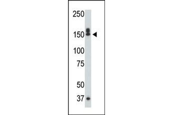 DAP Kinase 1 antibody  (C-Term)