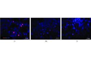 Immunofluorescence microscopy to examine the morphologies of cells from retinal organoids after exposure to immunosuppressants (a) Axons in the control group were long and strong and most expressed tubulin and NEFL (detected via immunofluorescence staining) indicating that the cells in this group could develop mature axons. (Ki-67 antibody  (AA 700-800))