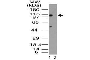 Western blot analysis of Importin-11 in HeLa lysate in the 1) absence and 2) presence of immunizing peptide. (Importin 11 antibody  (AA 1-50))