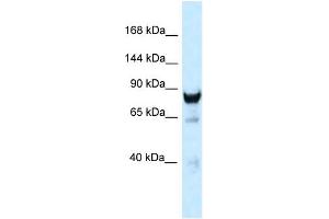 WB Suggested Anti-Dnm3 Antibody Titration: 1.