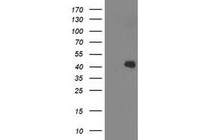 HEK293T cells were transfected with the pCMV6-ENTRY control (Left lane) or pCMV6-ENTRY ALDOB (Right lane) cDNA for 48 hrs and lysed. (ALDOB antibody)