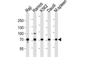 Western blot analysis of lysate from Raji, Ramos, K562, Daudi cell line and mouse spleen tissue lysate using BTK antibody at 1:1000. (BTK antibody  (AA 396-430))