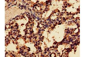 Immunohistochemistry of paraffin-embedded human lung tissue using ABIN7159273 at dilution of 1:100 (MAGEA8 antibody  (AA 1-270))