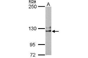 WB Image Sample (50 ug of whole cell lysate) A: Mouse brain 5% SDS PAGE antibody diluted at 1:1000 (NCKAP1 antibody)