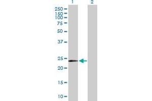 Western Blot analysis of MYCL1 expression in transfected 293T cell line by MYCL1 MaxPab polyclonal antibody. (LMYC antibody  (AA 1-206))