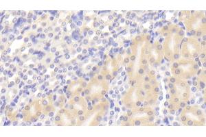 Detection of SOD3 in Mouse Kidney Tissue using Polyclonal Antibody to Superoxide Dismutase 3, Extracellular (SOD3) (SOD3 antibody  (AA 25-251))