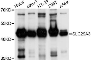 Western blot analysis of extracts of various cell lines, using SLC29A3 antibody (ABIN4905193) at 1:1000 dilution. (SLC29A3 antibody)