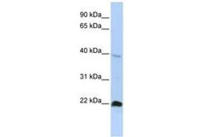 Image no. 1 for anti-NK3 Homeobox 2 (NKX3-2) (AA 251-300) antibody (ABIN6742350) (NKX3-2 antibody  (AA 251-300))