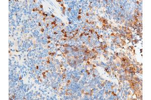 Immunohistochemistry (IHC) image for anti-Checkpoint Kinase 2 (CHEK2) (pSer516) antibody (ABIN6255391)